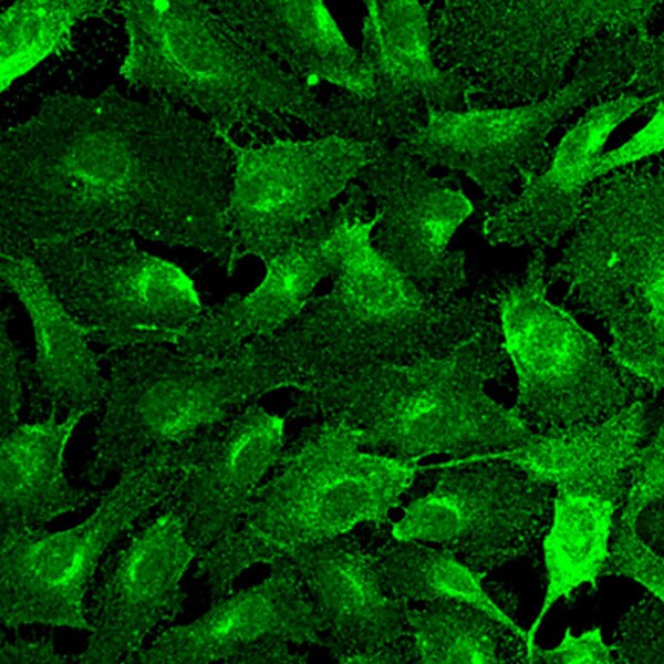 IF of human umbilical vein-derived endothelial cells (HUVECs) stained with DSHB antibody P4A4 against endoglin (green). Image credit: PMID 31540324, Fig. 4